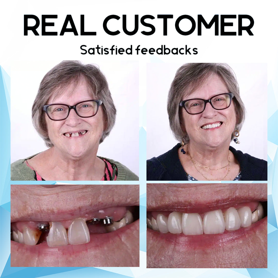 Furzero™ Silicone Reline Denture Set🦷✨